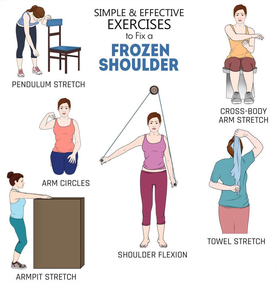 frozen-shoulder-sun-orthopaedic